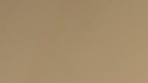 La piel reseca tiene sus propios cuidados conócelos | Crédito Pexels