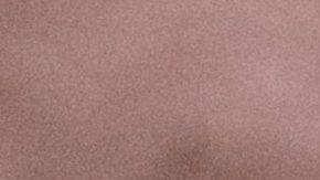 Lifting facial sin cirugía | Pexels