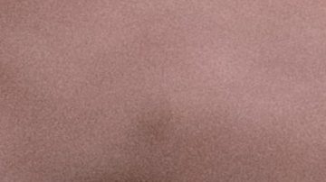 Lifting facial sin cirugía | Pexels