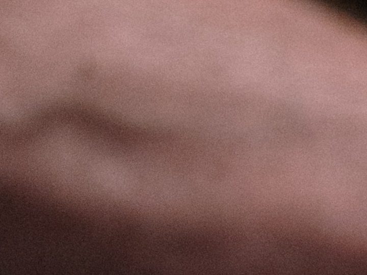 Lifting facial sin cirugía | Pexels