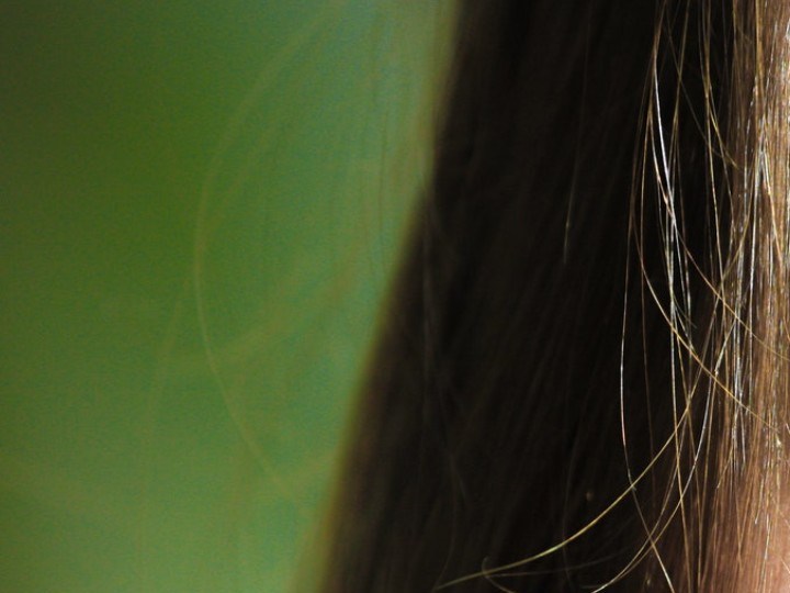 como tratar la caspa en las cejas