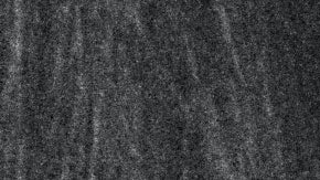 Consigue una nariz recta sin operación con la rinomodelación | Crédito Pexels.