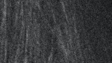 Consigue una nariz recta sin operación con la rinomodelación | Crédito Pexels.