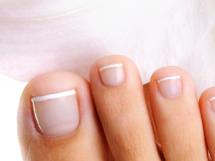 por qué salen hongos en las uñas de los pies y manos