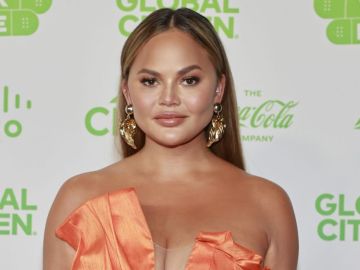 trasplante de cejas chrissy teigen