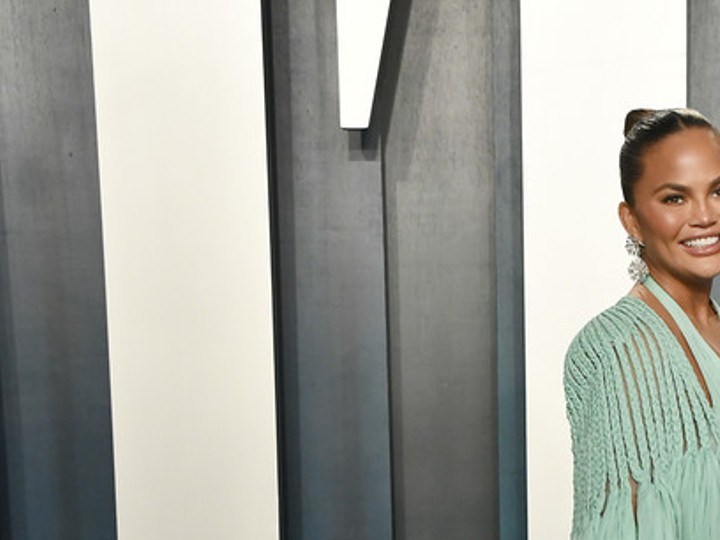 chrissy teigen trasplante cejas