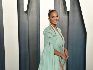 chrissy teigen trasplante cejas