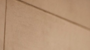 infecciones del cuero cabelludo