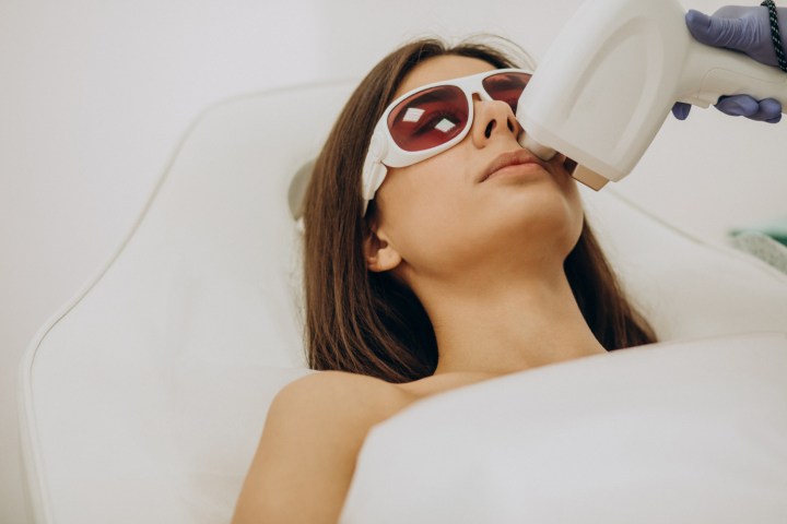 peel quimico vs tratamiento con laser