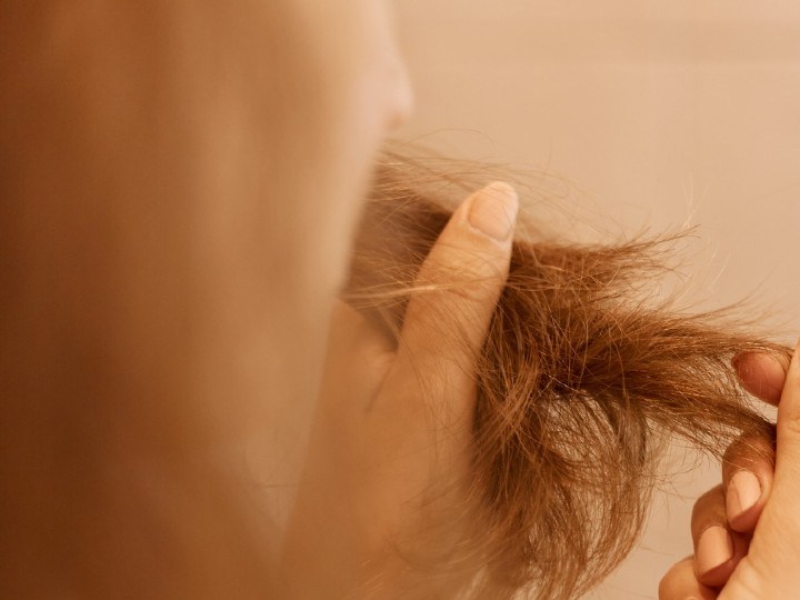 como tratar caida del pelo post covid-19