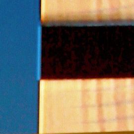 que cirugias se ha hecho belinda