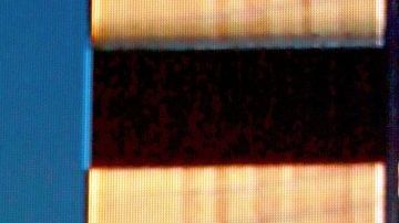 que cirugias se ha hecho belinda