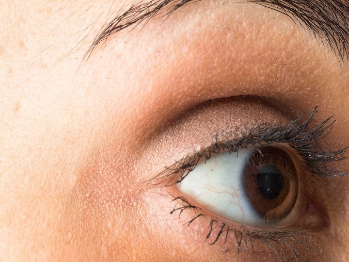 causas de las ojeras y bolsas en los ojos