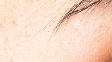 causas de las ojeras y bolsas en los ojos