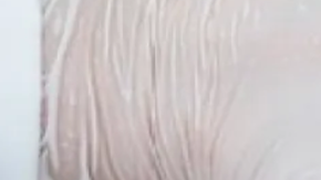 fillers para desaparecer ojeras