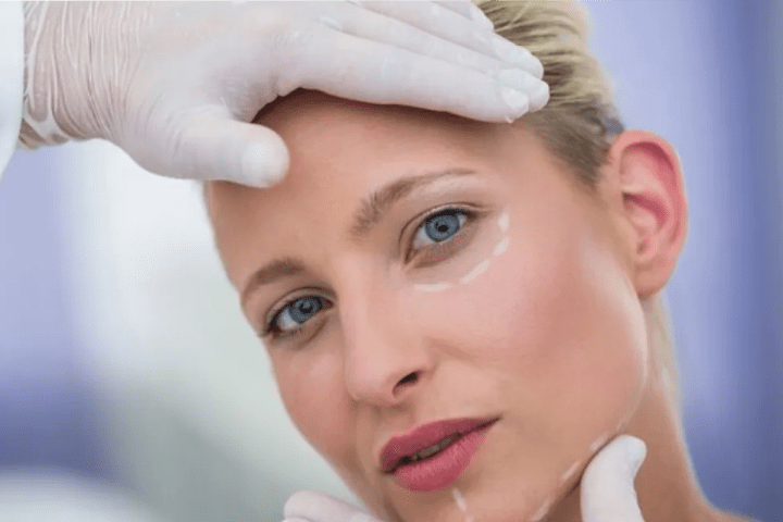 fillers para desaparecer ojeras