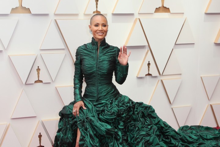 alopecia areata que es