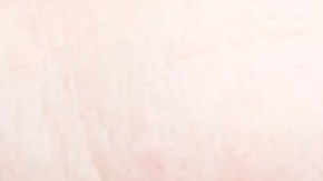 causas extrañas de las bolsas en los ojos