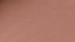 Celulitis