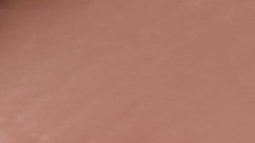 Celulitis