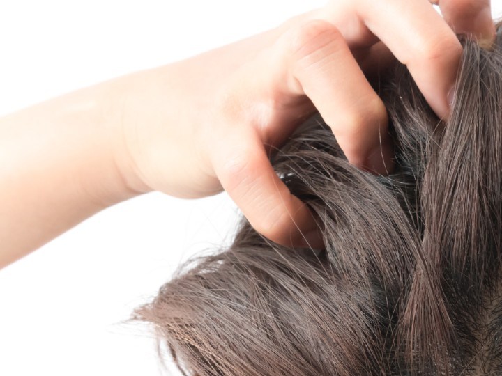como eliminar picazon del pelo
