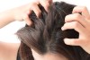 como eliminar picazon del pelo
