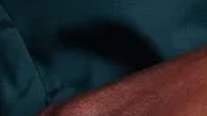 cremas para que los muslos no rocen