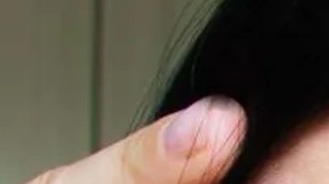 dermatox que es