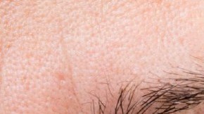 cientificos rejuvencen 30 años celulas piel