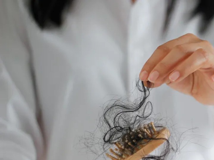 Por qué se produce la caida del cabello en las mujeres