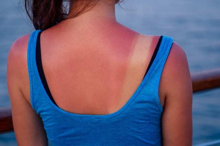 Qué es el envenenamiento solar