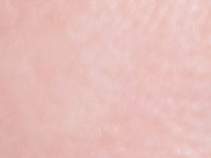Descubre para cuáles casos está recomendado el uso de parches para el acné