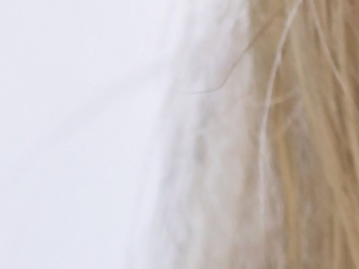 Arrugas en el cuello