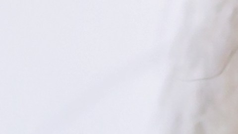 Arrugas en el cuello