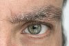 Caspa en las cejas