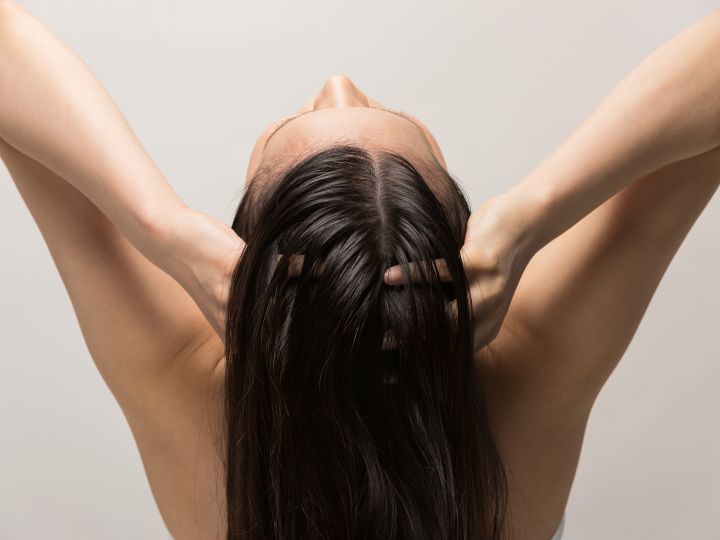 Exfoliación