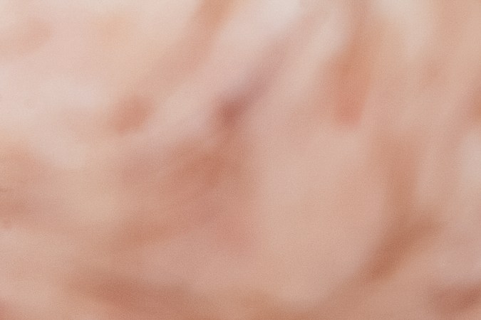 Besos