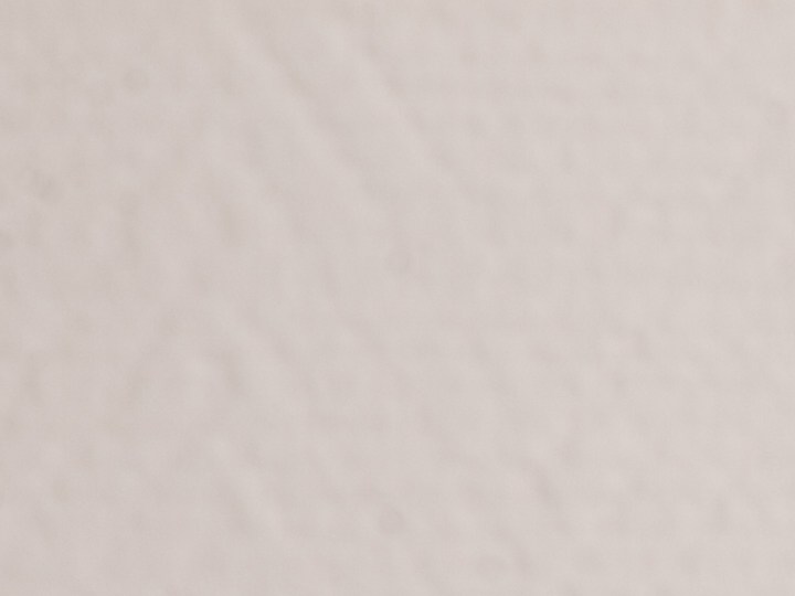 Flacidez facial