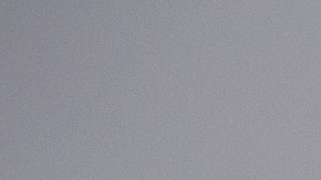 Piel grasa