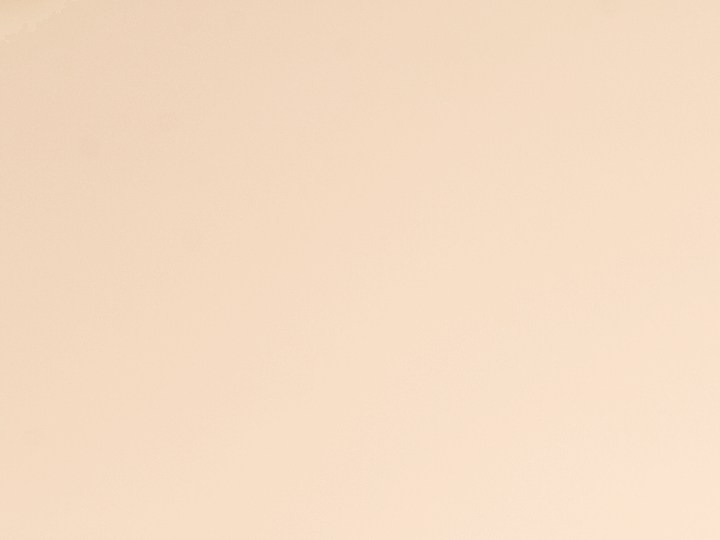 Puntos negros y blancos