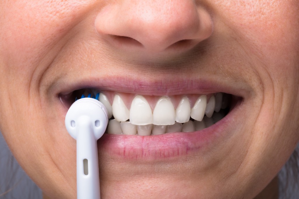 Dientes