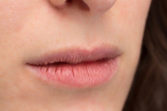 Labios