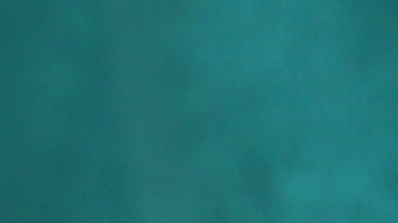 Quemaduras en la piel