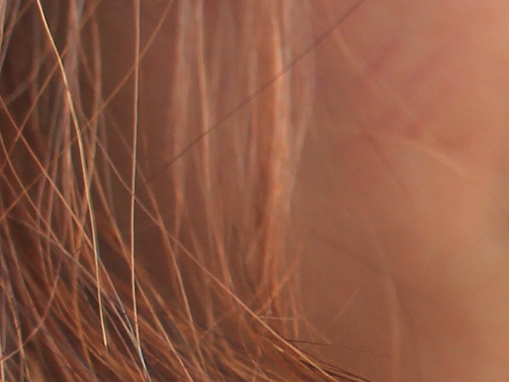 pelo