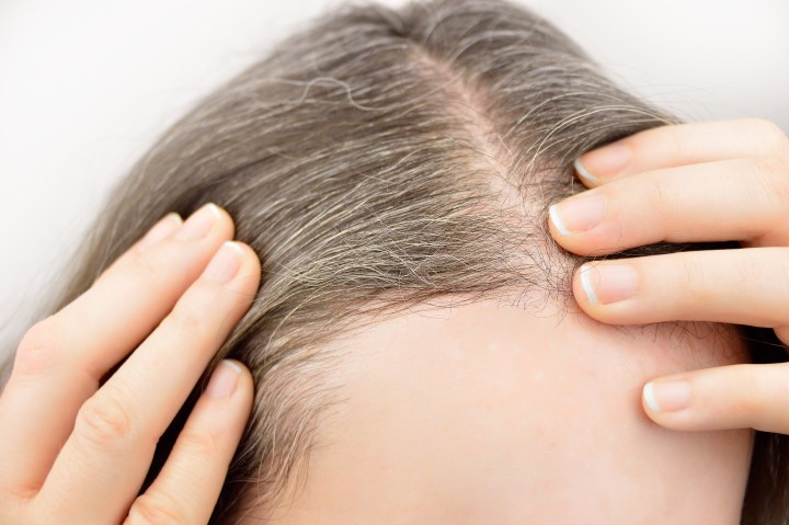 Canas