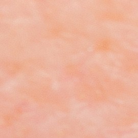 Labios resecos