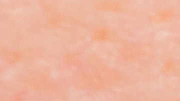 Labios resecos
