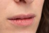 Labios resecos