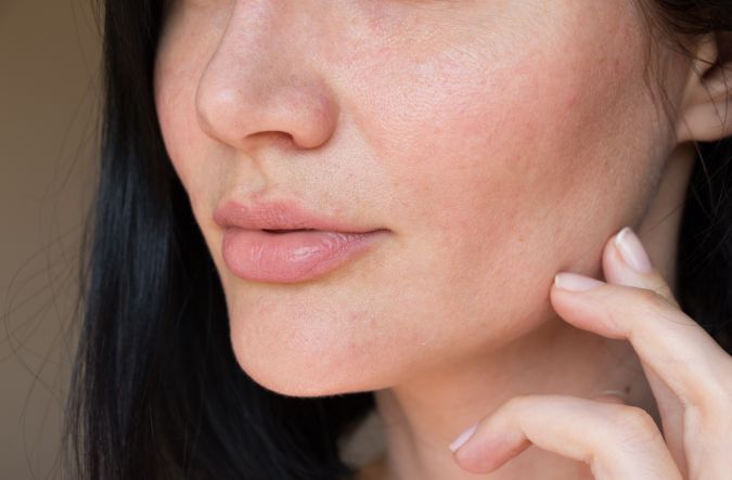 Labios resecos