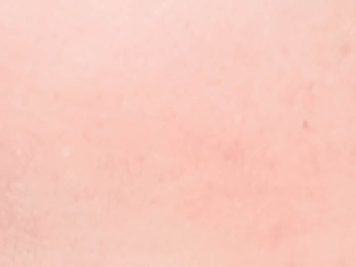 Axilas